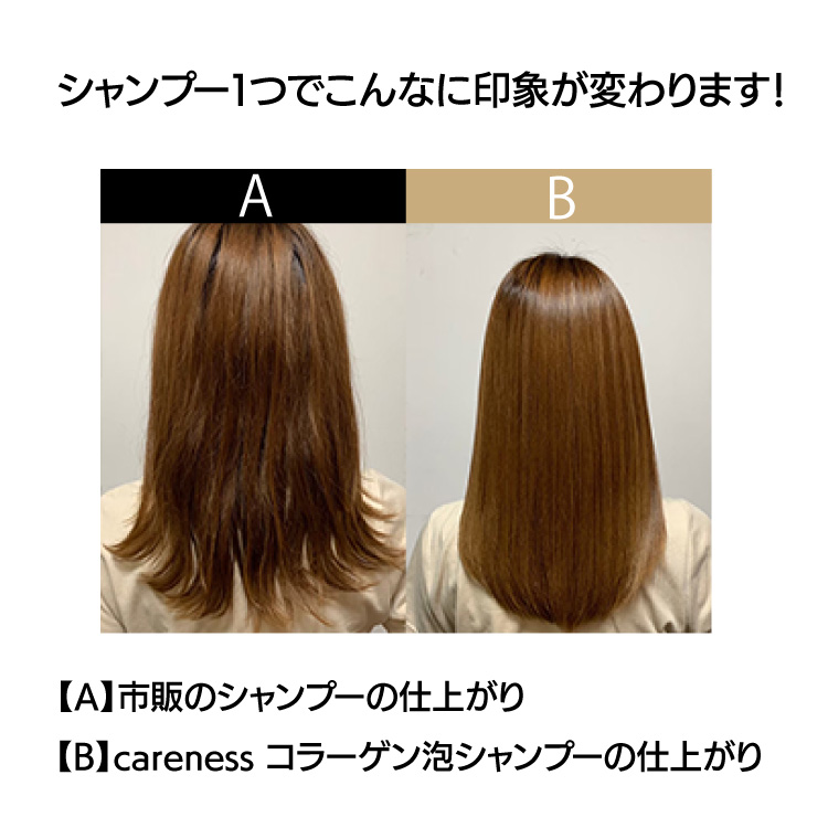 careness ケアネス